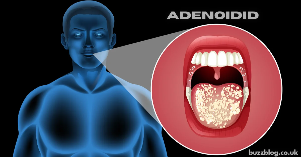 adenoidid