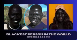 blackest person in the world