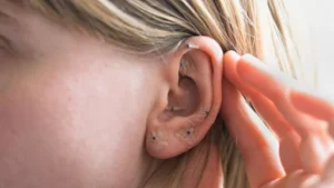 Ear Seeding