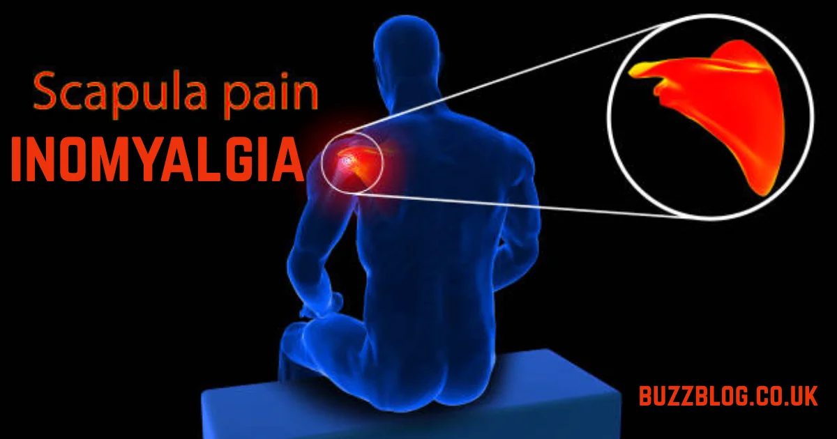 inomyalgia