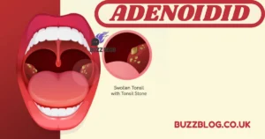 adenoidid