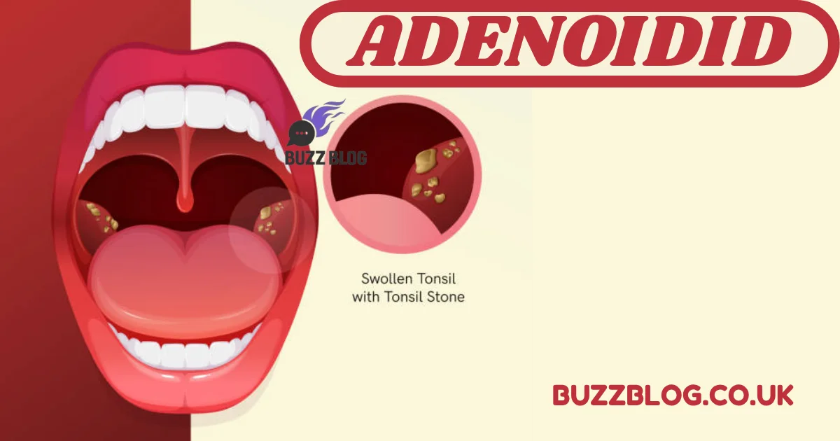 adenoidid